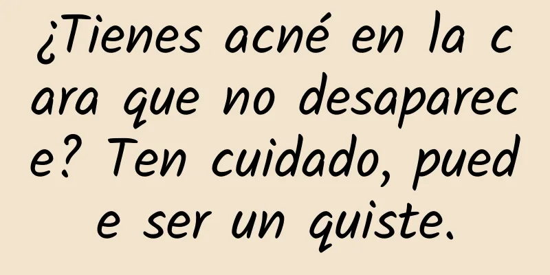 ¿Tienes acné en la cara que no desaparece? Ten cuidado, puede ser un quiste.