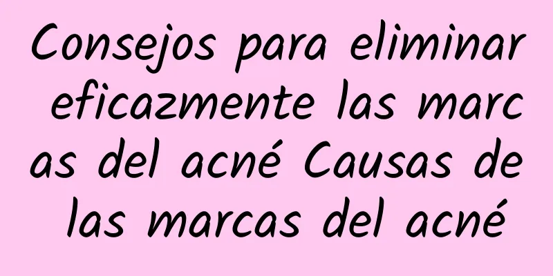 Consejos para eliminar eficazmente las marcas del acné Causas de las marcas del acné