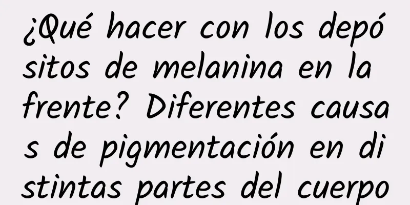 ¿Qué hacer con los depósitos de melanina en la frente? Diferentes causas de pigmentación en distintas partes del cuerpo