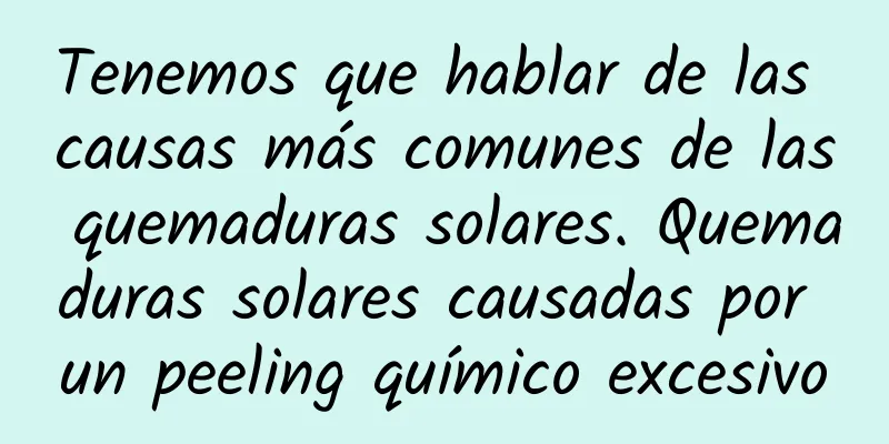 Tenemos que hablar de las causas más comunes de las quemaduras solares. Quemaduras solares causadas por un peeling químico excesivo