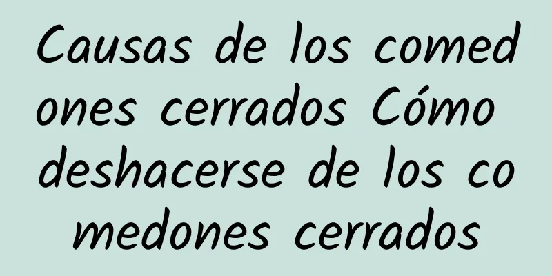 Causas de los comedones cerrados Cómo deshacerse de los comedones cerrados