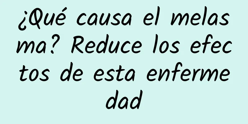 ¿Qué causa el melasma? Reduce los efectos de esta enfermedad