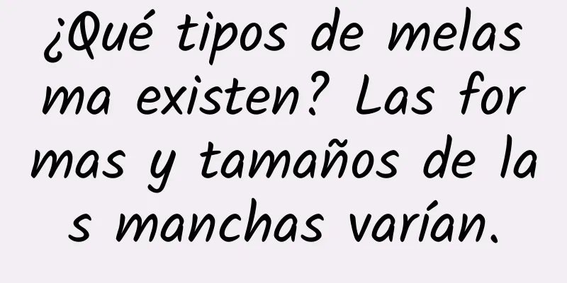 ¿Qué tipos de melasma existen? Las formas y tamaños de las manchas varían.