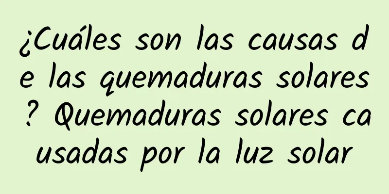 ¿Cuáles son las causas de las quemaduras solares? Quemaduras solares causadas por la luz solar