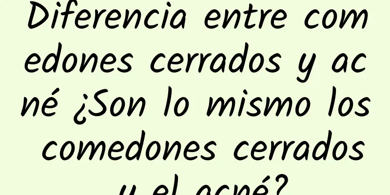 Diferencia entre comedones cerrados y acné ¿Son lo mismo los comedones cerrados y el acné?