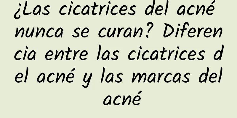 ¿Las cicatrices del acné nunca se curan? Diferencia entre las cicatrices del acné y las marcas del acné