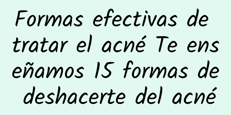 Formas efectivas de tratar el acné Te enseñamos 15 formas de deshacerte del acné