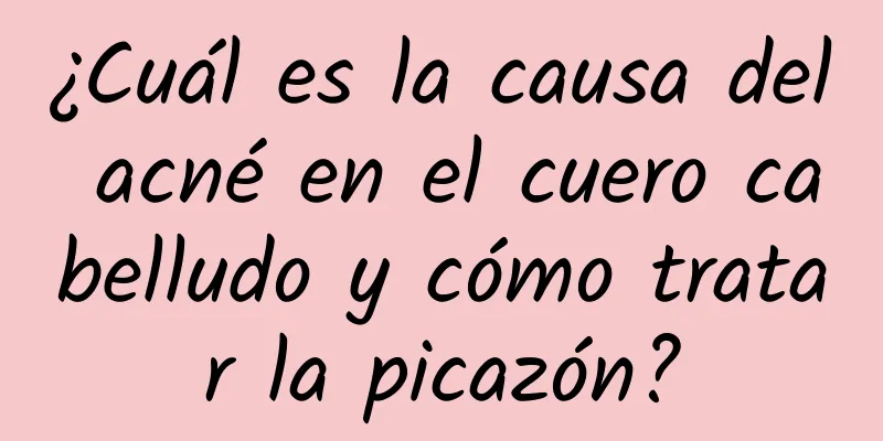 ¿Cuál es la causa del acné en el cuero cabelludo y cómo tratar la picazón?