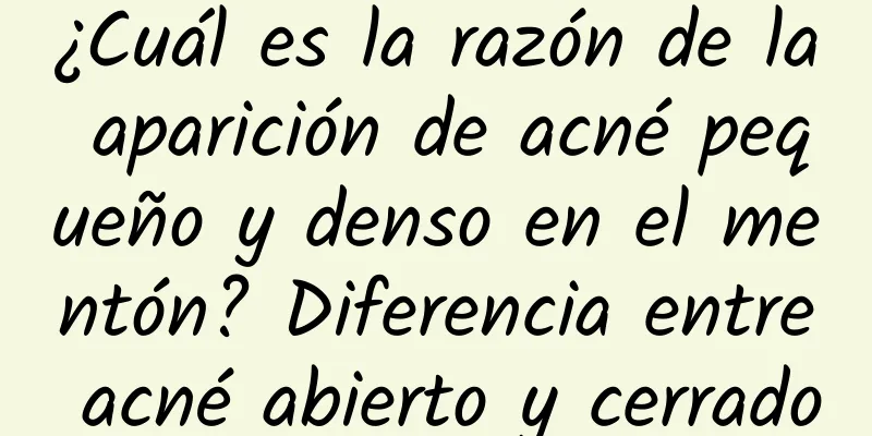 ¿Cuál es la razón de la aparición de acné pequeño y denso en el mentón? Diferencia entre acné abierto y cerrado