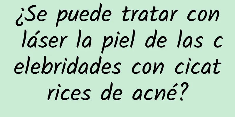 ¿Se puede tratar con láser la piel de las celebridades con cicatrices de acné?