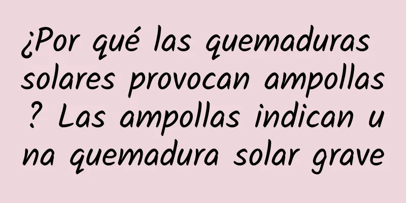 ¿Por qué las quemaduras solares provocan ampollas? Las ampollas indican una quemadura solar grave