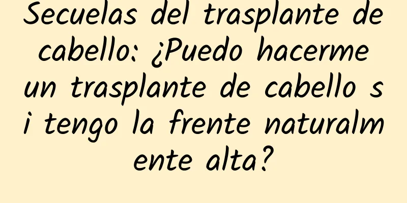 Secuelas del trasplante de cabello: ¿Puedo hacerme un trasplante de cabello si tengo la frente naturalmente alta?