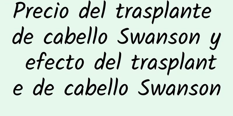 Precio del trasplante de cabello Swanson y efecto del trasplante de cabello Swanson