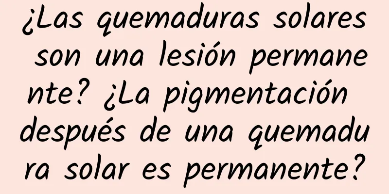 ¿Las quemaduras solares son una lesión permanente? ¿La pigmentación después de una quemadura solar es permanente?