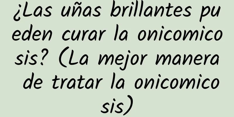 ¿Las uñas brillantes pueden curar la onicomicosis? (La mejor manera de tratar la onicomicosis)