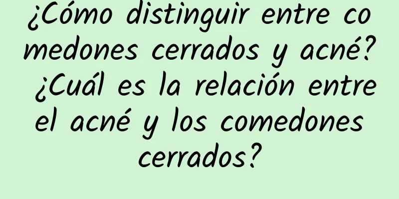 ¿Cómo distinguir entre comedones cerrados y acné? ¿Cuál es la relación entre el acné y los comedones cerrados?