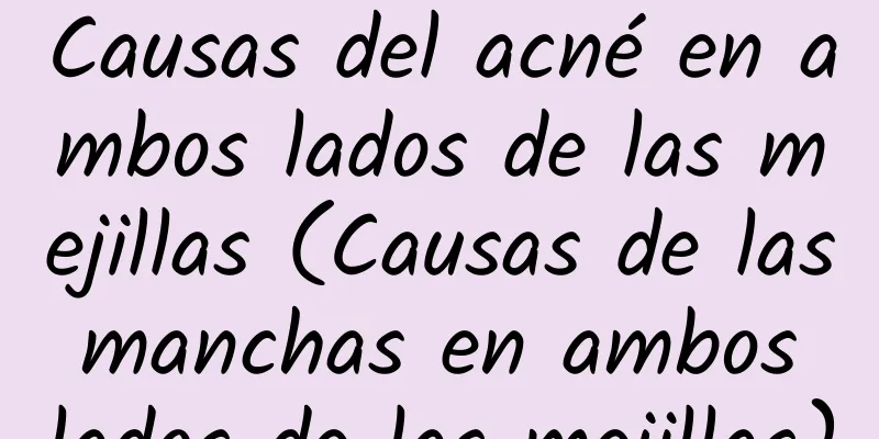 Causas del acné en ambos lados de las mejillas (Causas de las manchas en ambos lados de las mejillas)