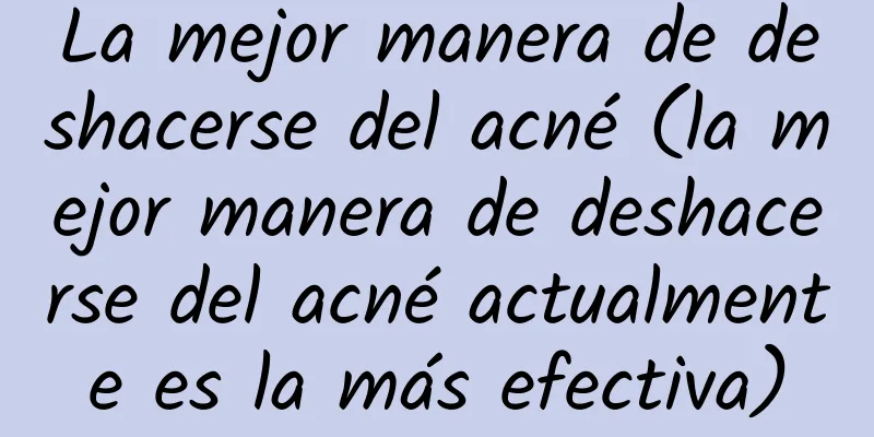 La mejor manera de deshacerse del acné (la mejor manera de deshacerse del acné actualmente es la más efectiva)