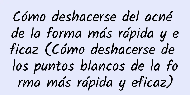 Cómo deshacerse del acné de la forma más rápida y eficaz (Cómo deshacerse de los puntos blancos de la forma más rápida y eficaz)