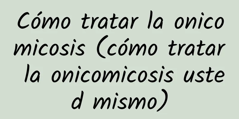 Cómo tratar la onicomicosis (cómo tratar la onicomicosis usted mismo)