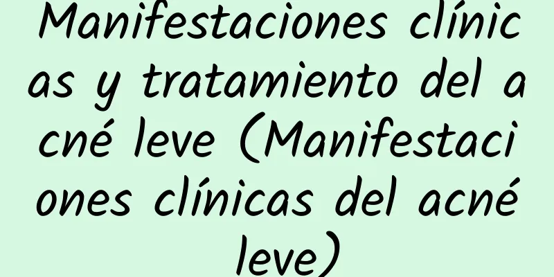 Manifestaciones clínicas y tratamiento del acné leve (Manifestaciones clínicas del acné leve)