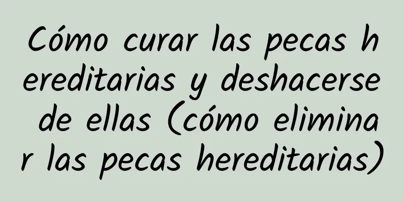 Cómo curar las pecas hereditarias y deshacerse de ellas (cómo eliminar las pecas hereditarias)