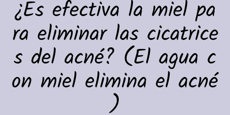 ¿Es efectiva la miel para eliminar las cicatrices del acné? (El agua con miel elimina el acné)