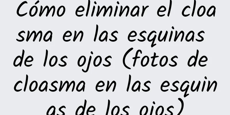 Cómo eliminar el cloasma en las esquinas de los ojos (fotos de cloasma en las esquinas de los ojos)