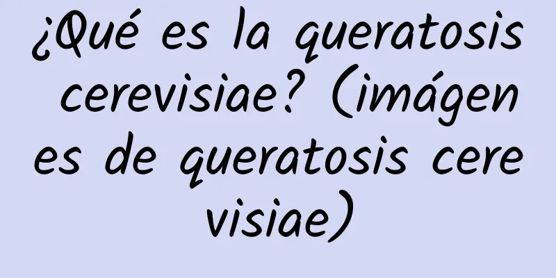 ¿Qué es la queratosis cerevisiae? (imágenes de queratosis cerevisiae)