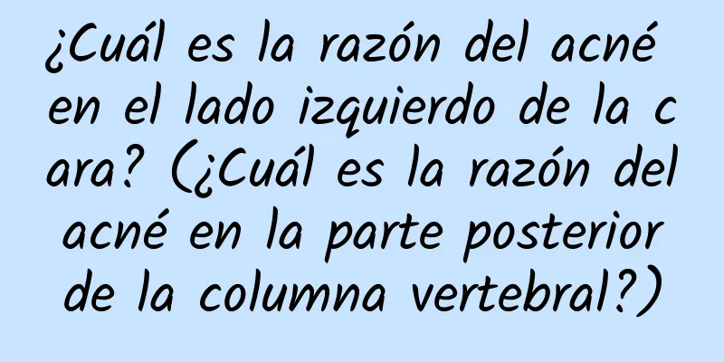 ¿Cuál es la razón del acné en el lado izquierdo de la cara? (¿Cuál es la razón del acné en la parte posterior de la columna vertebral?)