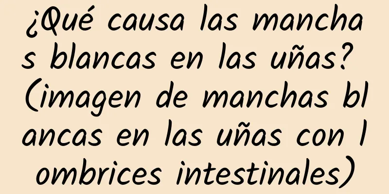 ¿Qué causa las manchas blancas en las uñas? (imagen de manchas blancas en las uñas con lombrices intestinales)