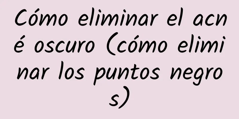 Cómo eliminar el acné oscuro (cómo eliminar los puntos negros)