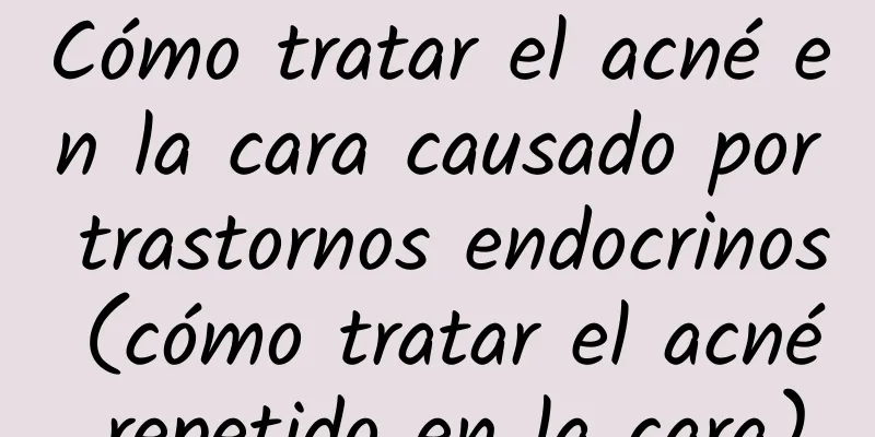 Cómo tratar el acné en la cara causado por trastornos endocrinos (cómo tratar el acné repetido en la cara)