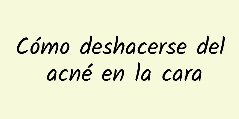 Cómo deshacerse del acné en la cara