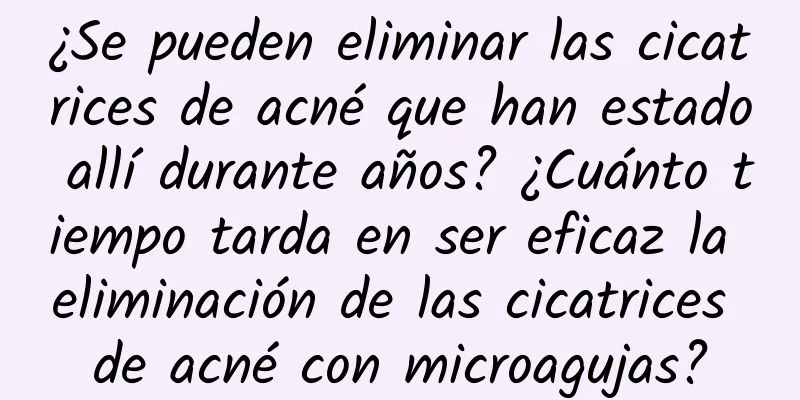 ¿Se pueden eliminar las cicatrices de acné que han estado allí durante años? ¿Cuánto tiempo tarda en ser eficaz la eliminación de las cicatrices de acné con microagujas?