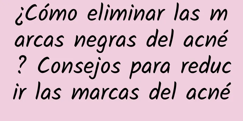 ¿Cómo eliminar las marcas negras del acné? Consejos para reducir las marcas del acné