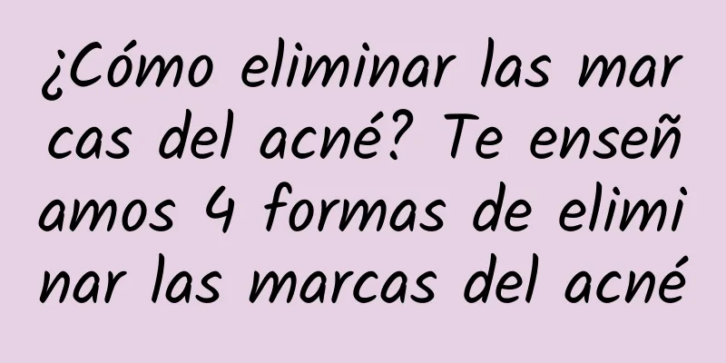 ¿Cómo eliminar las marcas del acné? Te enseñamos 4 formas de eliminar las marcas del acné