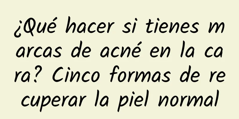 ¿Qué hacer si tienes marcas de acné en la cara? Cinco formas de recuperar la piel normal