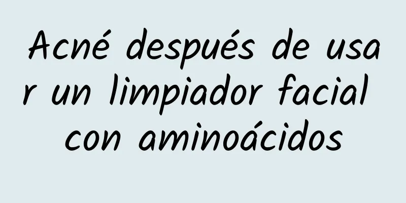 Acné después de usar un limpiador facial con aminoácidos