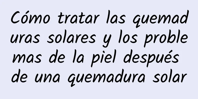 Cómo tratar las quemaduras solares y los problemas de la piel después de una quemadura solar