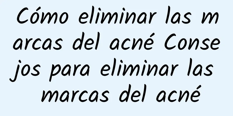Cómo eliminar las marcas del acné Consejos para eliminar las marcas del acné