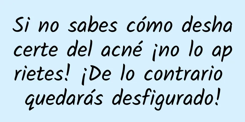 Si no sabes cómo deshacerte del acné ¡no lo aprietes! ¡De lo contrario quedarás desfigurado!