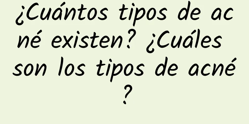 ¿Cuántos tipos de acné existen? ¿Cuáles son los tipos de acné?