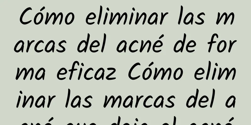 Cómo eliminar las marcas del acné de forma eficaz Cómo eliminar las marcas del acné que deja el acné