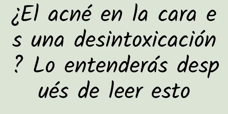 ¿El acné en la cara es una desintoxicación? Lo entenderás después de leer esto