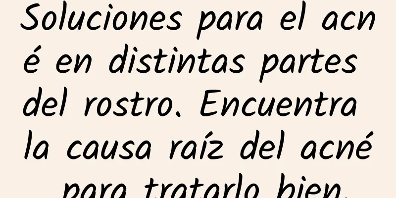 Soluciones para el acné en distintas partes del rostro. Encuentra la causa raíz del acné para tratarlo bien.