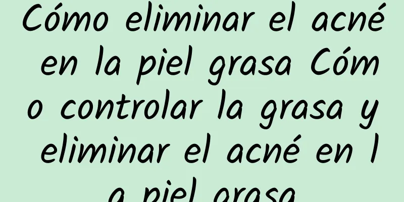 Cómo eliminar el acné en la piel grasa Cómo controlar la grasa y eliminar el acné en la piel grasa