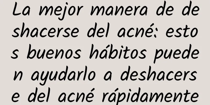 La mejor manera de deshacerse del acné: estos buenos hábitos pueden ayudarlo a deshacerse del acné rápidamente