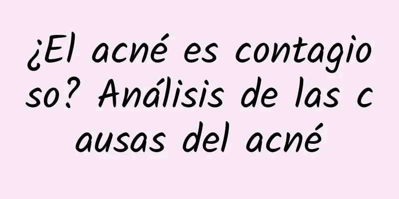 ¿El acné es contagioso? Análisis de las causas del acné