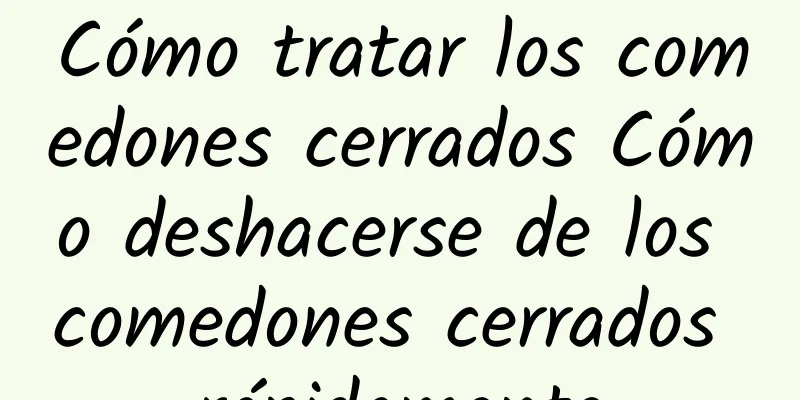 Cómo tratar los comedones cerrados Cómo deshacerse de los comedones cerrados rápidamente